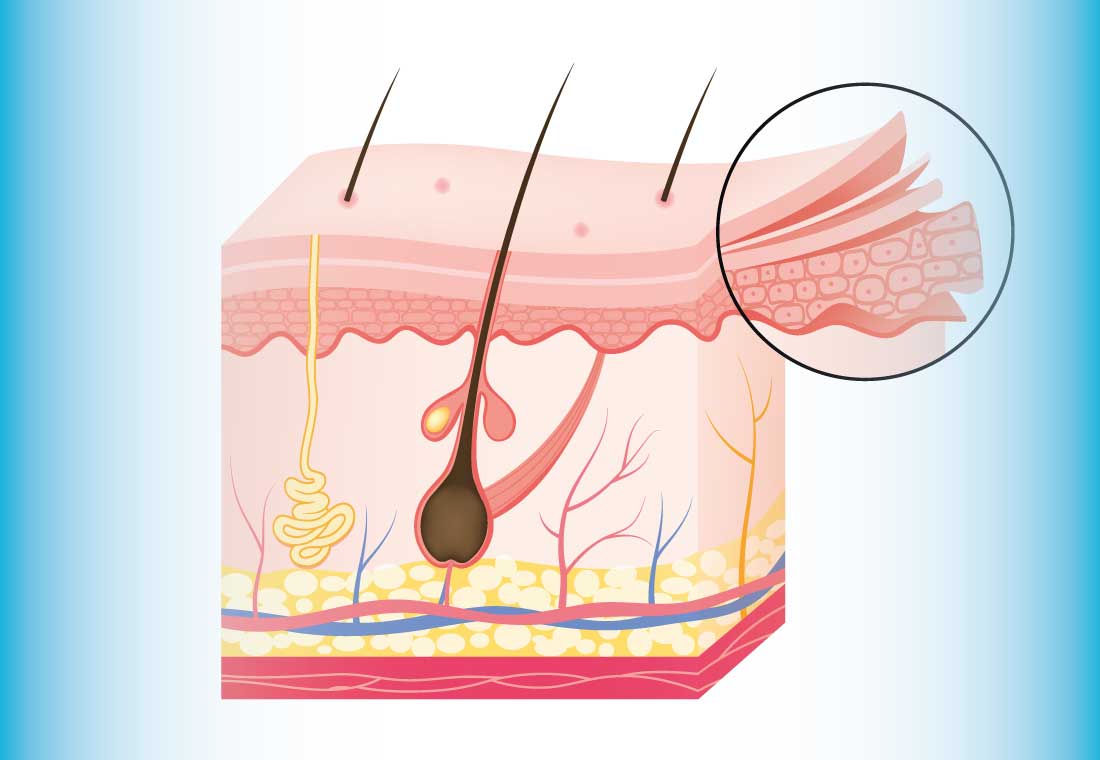 skin tears in the elderly