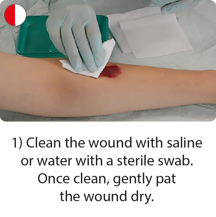 How to apply and remove skin tear dressings