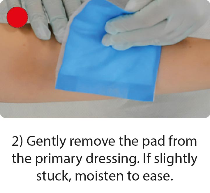 How to apply and remove skin tear dressings