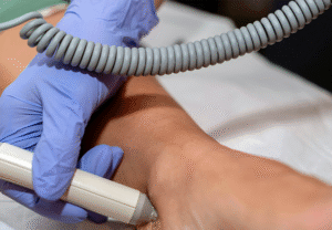 Difference between venous and arterial leg ulcers